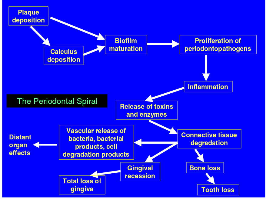 The Periodontal Spiral